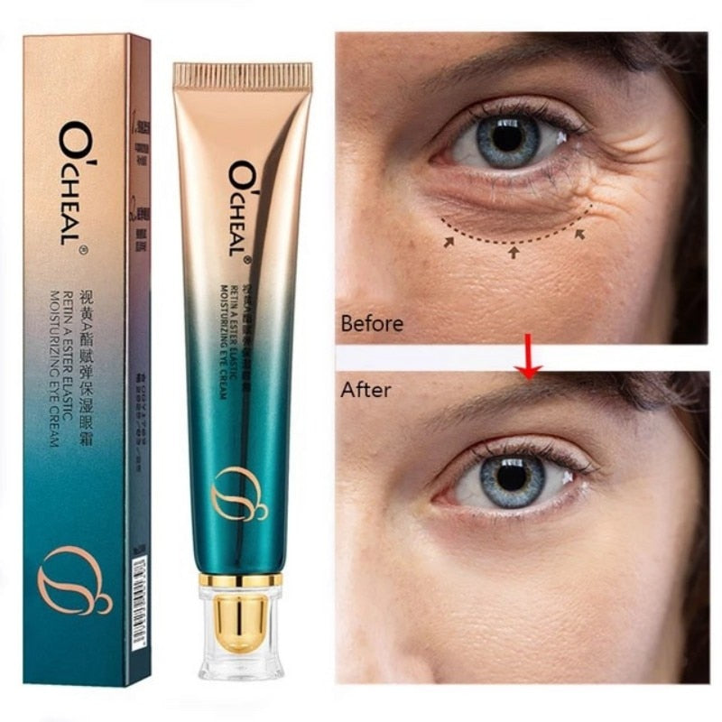 New Anti-Wrinkle Eye Cream Visible Results within Weeks. 