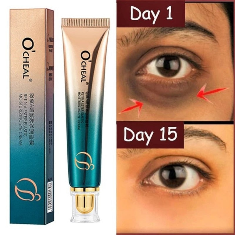 New Anti-Wrinkle Eye Cream Visible Results within Weeks. 